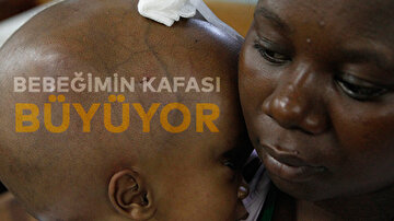 Bebeğimin Kafası Büyüyor